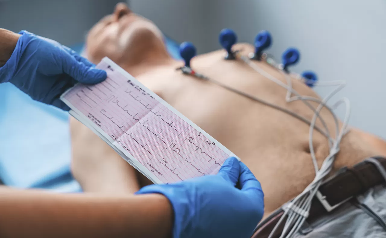 Eletrocardiograma