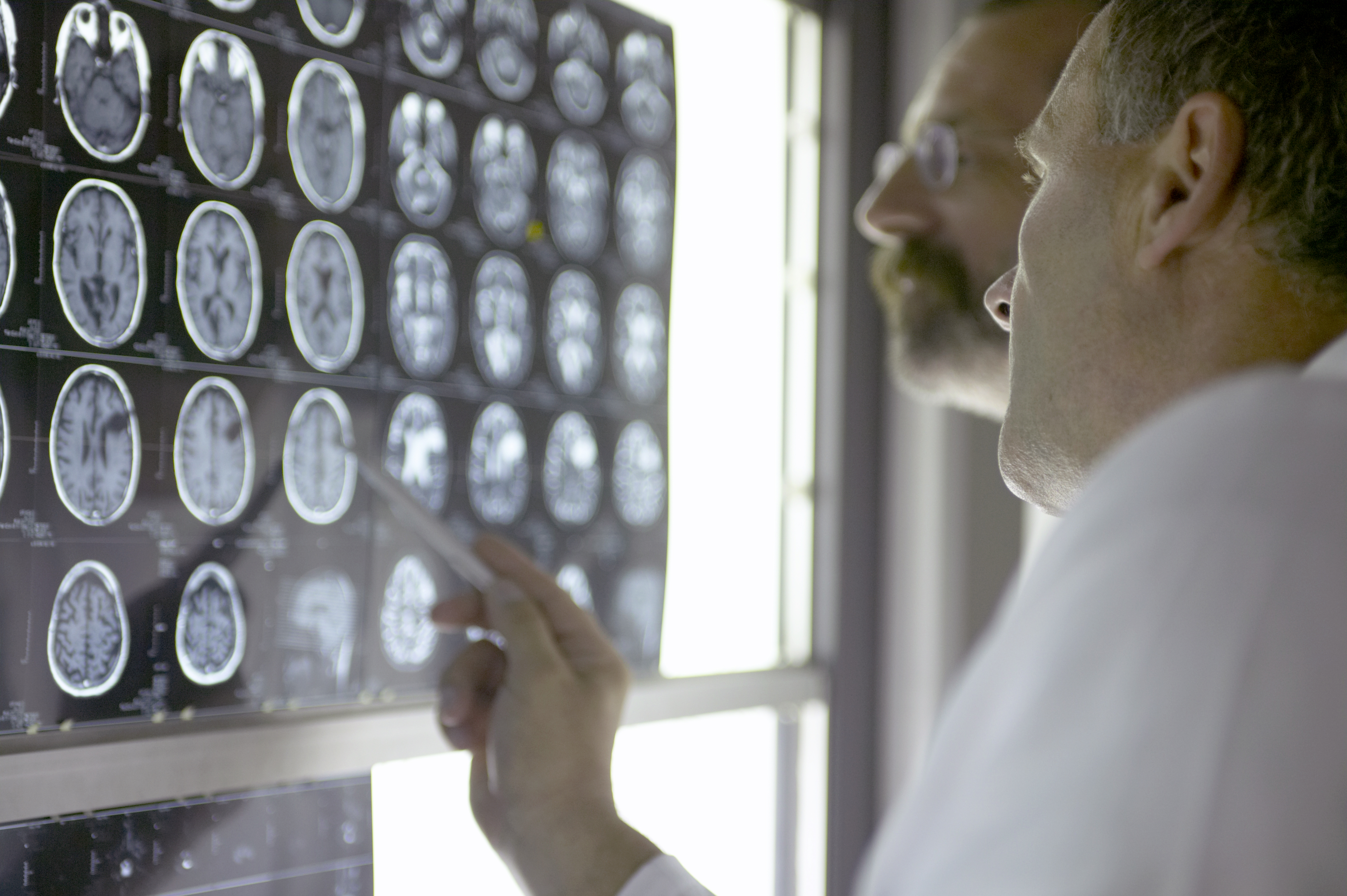 Neurologia